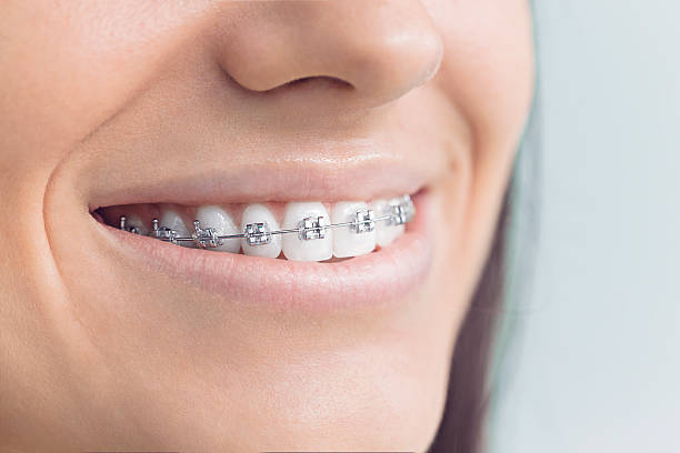 Best Teeth Whitening  in Thonotosassa, FL